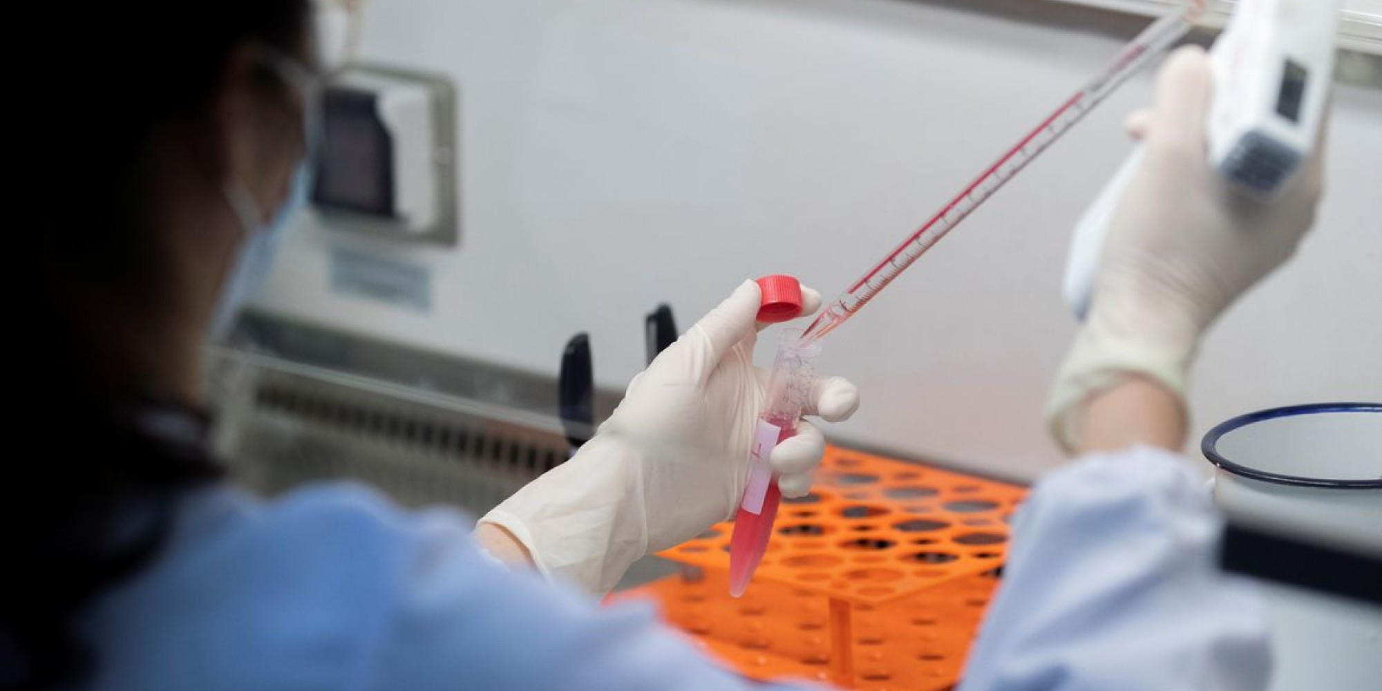 Cidades da Amvat ainda somam 49.014 infectados desde o início da pandemia Cidades da Amvat ainda somam 49.014 infectados desde o início da pandemia