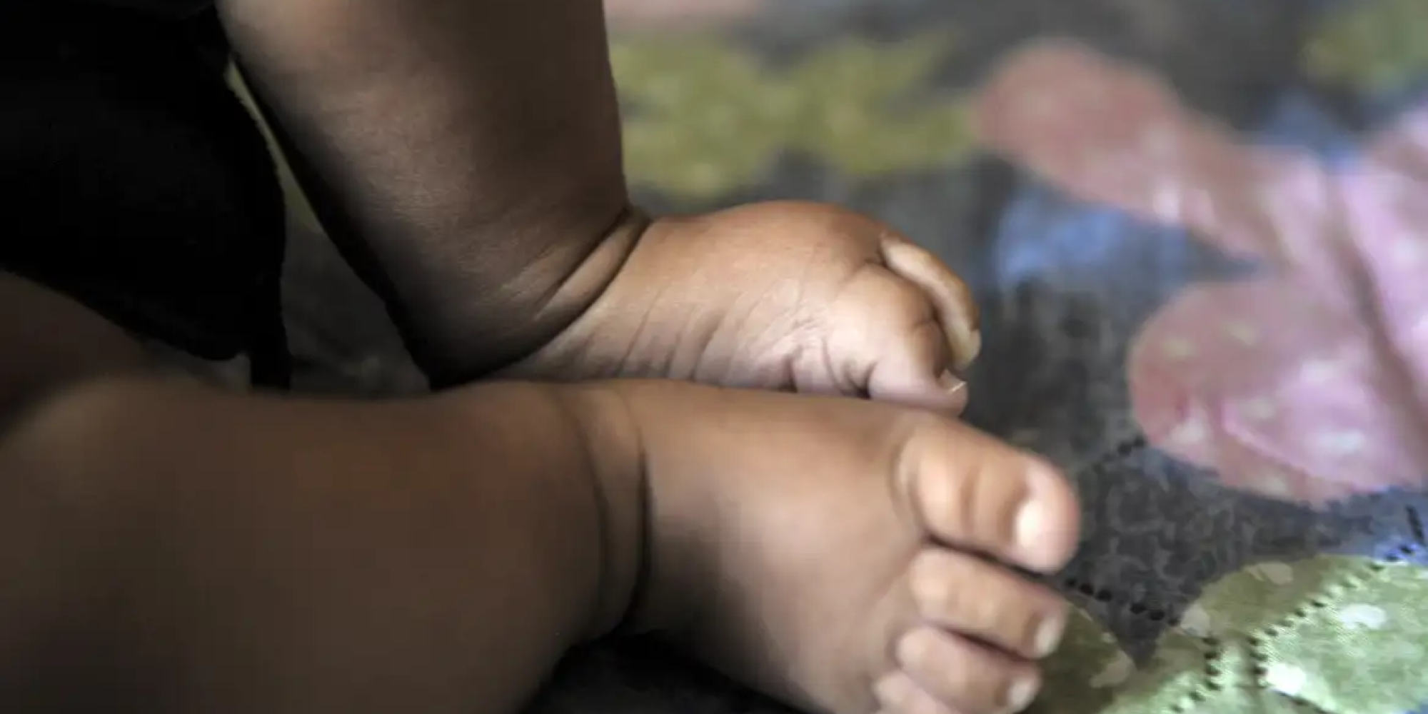 Bebê de 1 ano entra em coma após dosagem errada de medicação