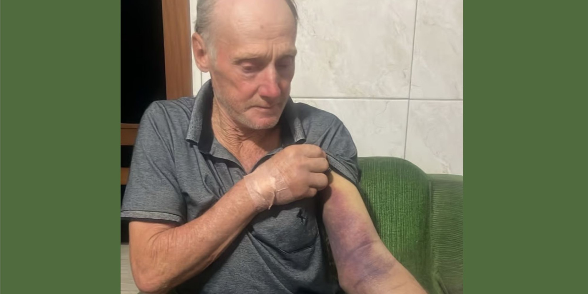 Morador de Putinga é picado por cobra jararaca
