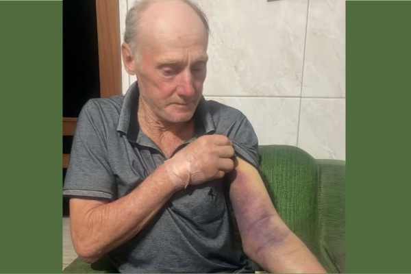 Morador de Putinga é picado por cobra jararaca