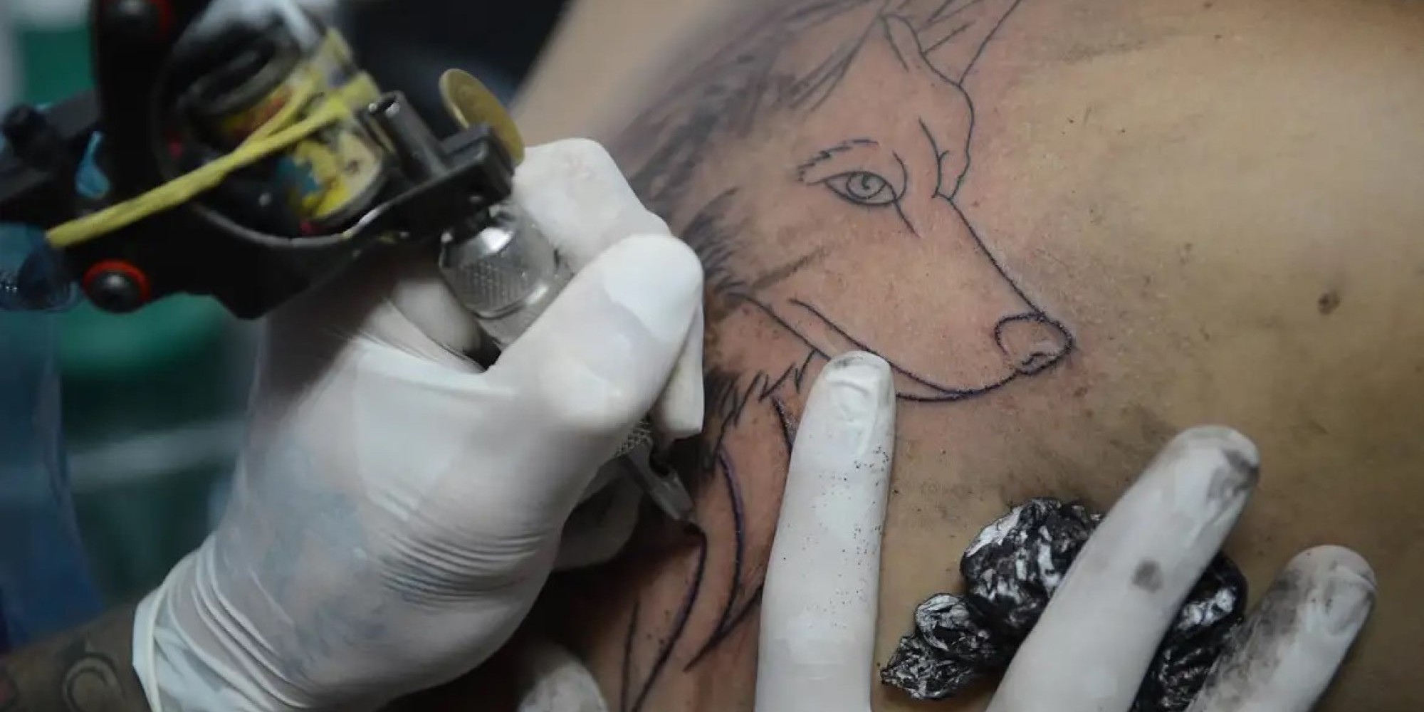 CFM proíbe uso de anestesia geral e sedação para realização de tatuagens estéticas