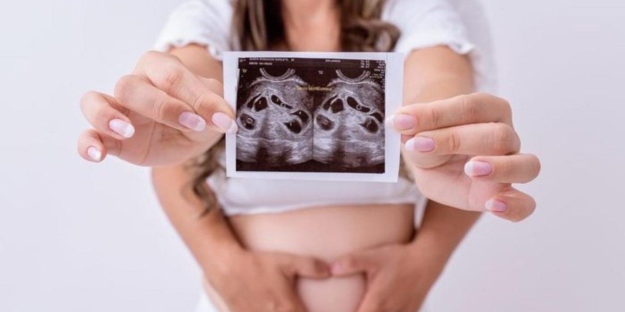 Mãe dá à luz a sêxtuplos em parto de 10 minutos no Espírito Santo
