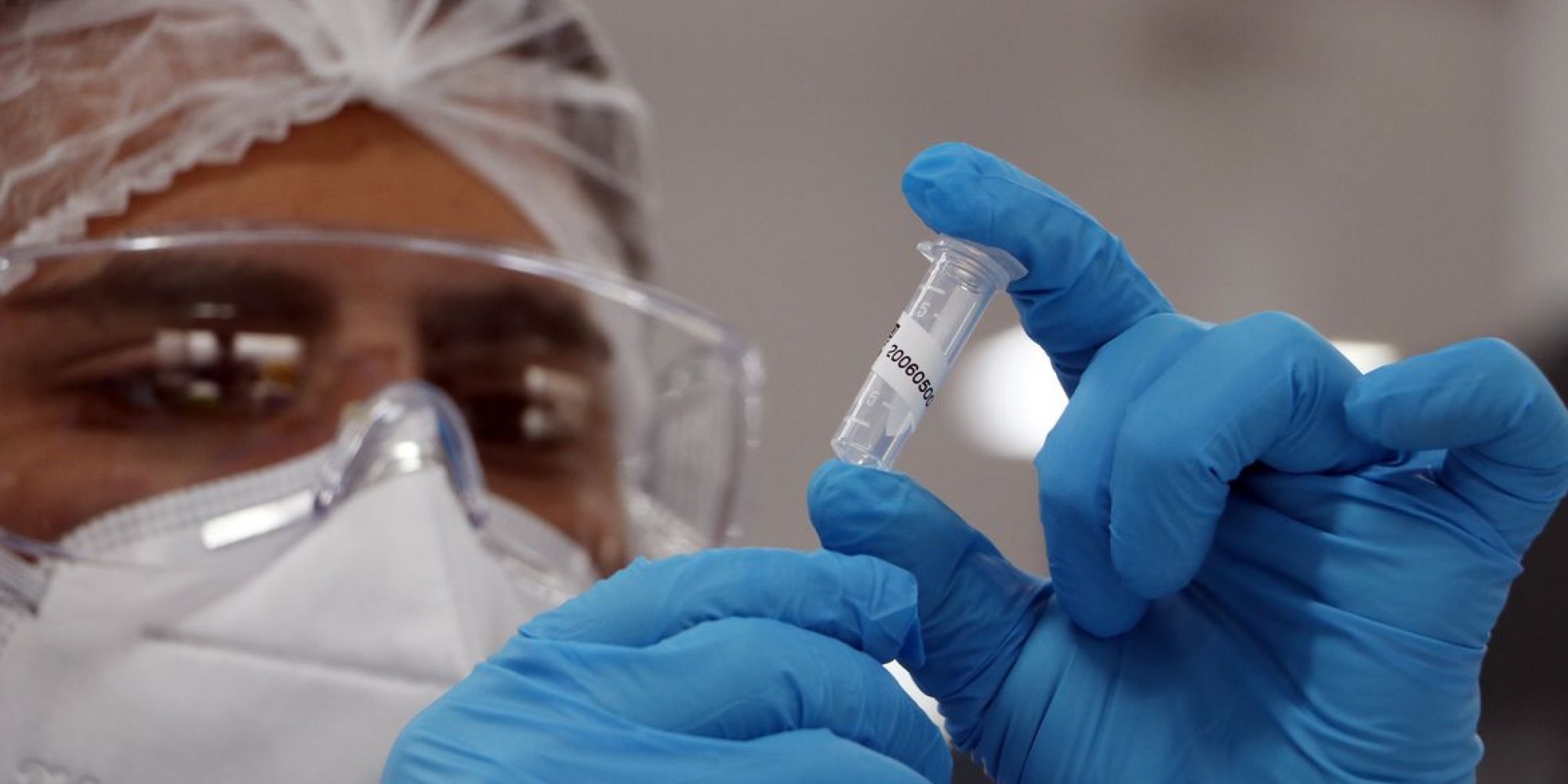 COVID-19: Região contabiliza 872 óbitos e 48.141 resultados positivos