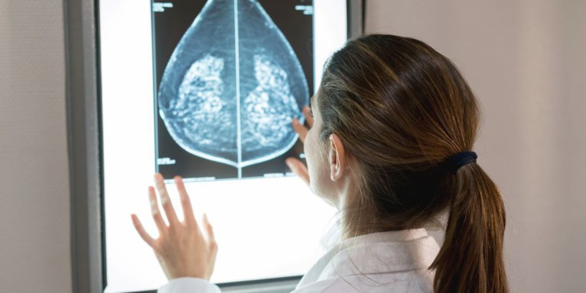 Exame poderá ser feito sob demanda mesmo sem sintomas, em decisão com o profissional de saúde. Medida pretende ampliar a detecção precoce do câncer de mama. Exame poderá ser feito sob demanda mesmo sem sintomas, em decisão com o profissional de saúde. Medida pretende ampliar a detecção precoce do câncer de mama.