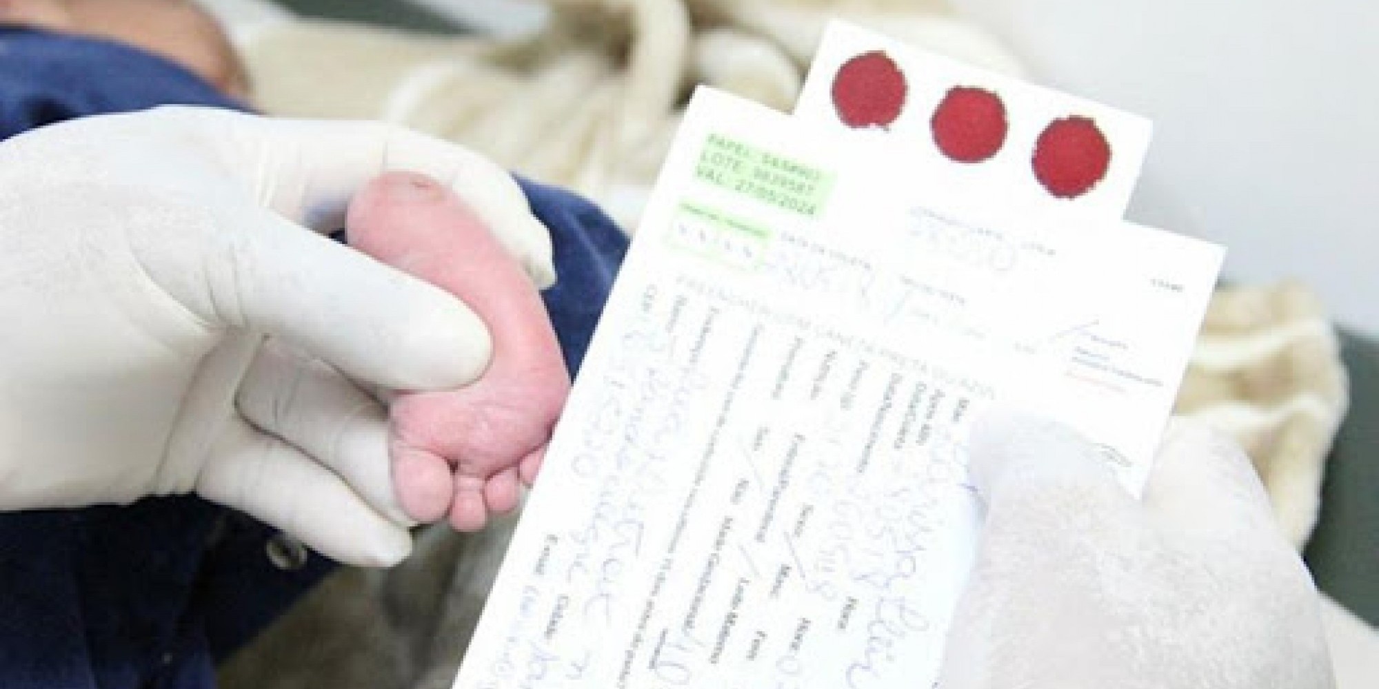 A partir deste ano, todos os recém-nascidos devem ser submetidos ao exame de toxoplasmose congênita SUS A partir deste ano, todos os recém-nascidos devem ser submetidos ao exame de toxoplasmose congênita SUS